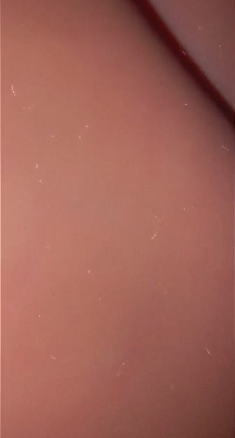 Bihter Tendu Domalmis Kalca Tokati Am Aralama